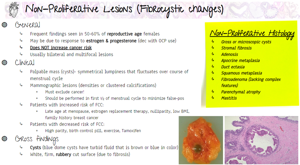 High Yield Breast Pathology Fibrocystic Changes