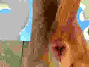 Inflamação na Glândula Anal ou Adanal do cão. A inflamação causa inchaço, vermelhidão e dor. Fique atento aos sintomas do seu Pet.