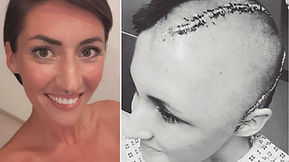 TBI One Love Survivor Francesca Burr