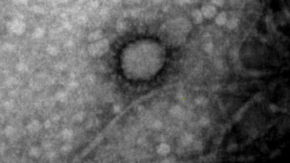 El Ministerio de Ciencia financia proyecto que busca proteger a los pulmones del coronavirus