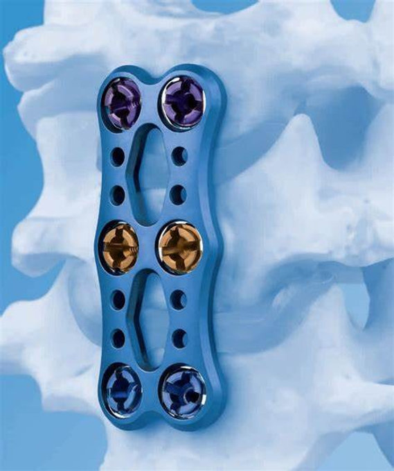 DePuy Synthes VECTRA Cervical Plate System. Catalog 04.613.239