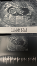 Little gummy bear!