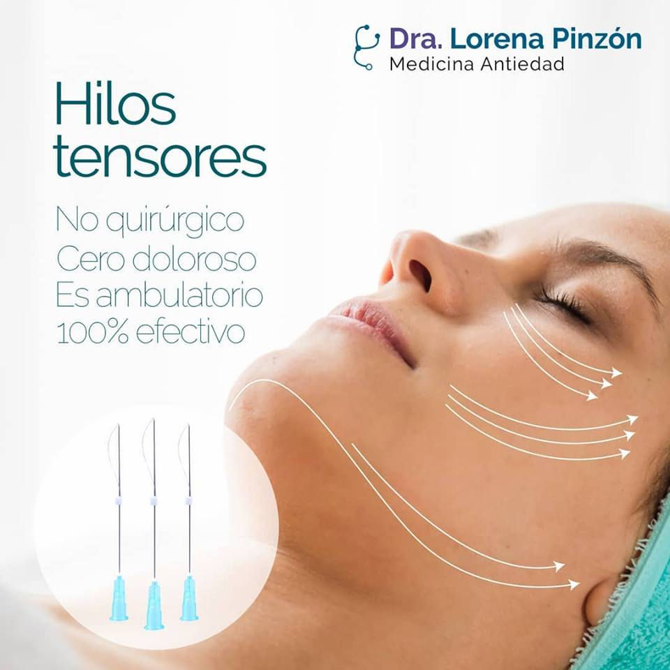 Hilos Tensores Bogota | Tratamiento Flacidez Facial