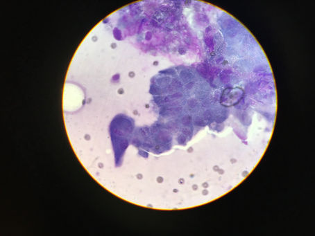 Case of a lumpy cat