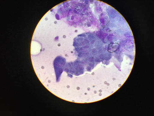 Case of a lumpy cat