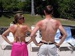 sunburn, triathletes