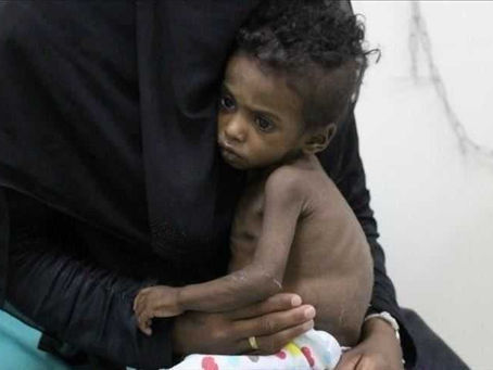 رصد 24 إصابة مؤكدة بفيروس "غرب النيل" في تعز اليمني