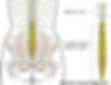 Anatomical drawing of an upper body highlighting the site of cauda equina syndrome