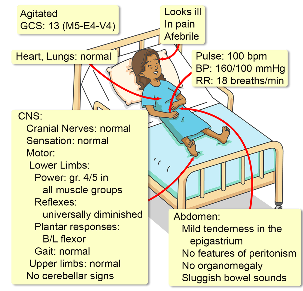 Acute intermittent porphyria