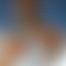 Portadores de AME aguardam incorporação de medicamento ao SUS