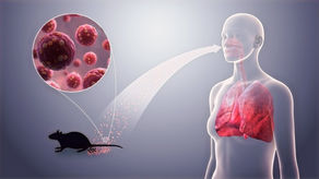 Why is everyone talking about Hantavirus?