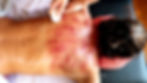 Gua Sha red dots appearing on skin - Dark sha indicating a deeper problem