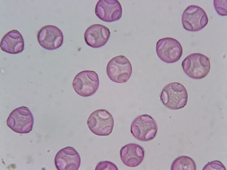 First Pollen Slide content media