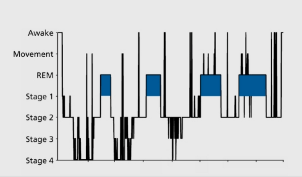 Deep sleep is during stages 3 and 4.