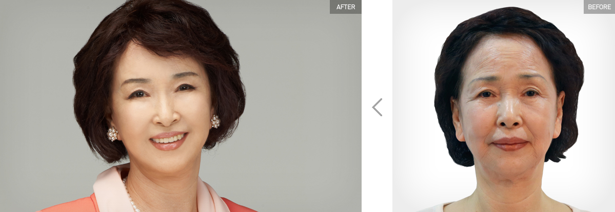 Anti-Aging content media