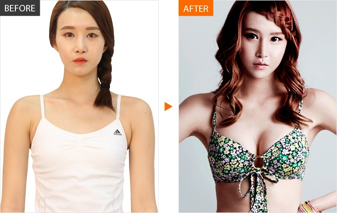 Breast content media