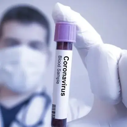 Slide Leaking to Seriously Seriousness of Corona Virus