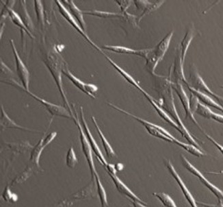 Lameness-Stemcells.jpg