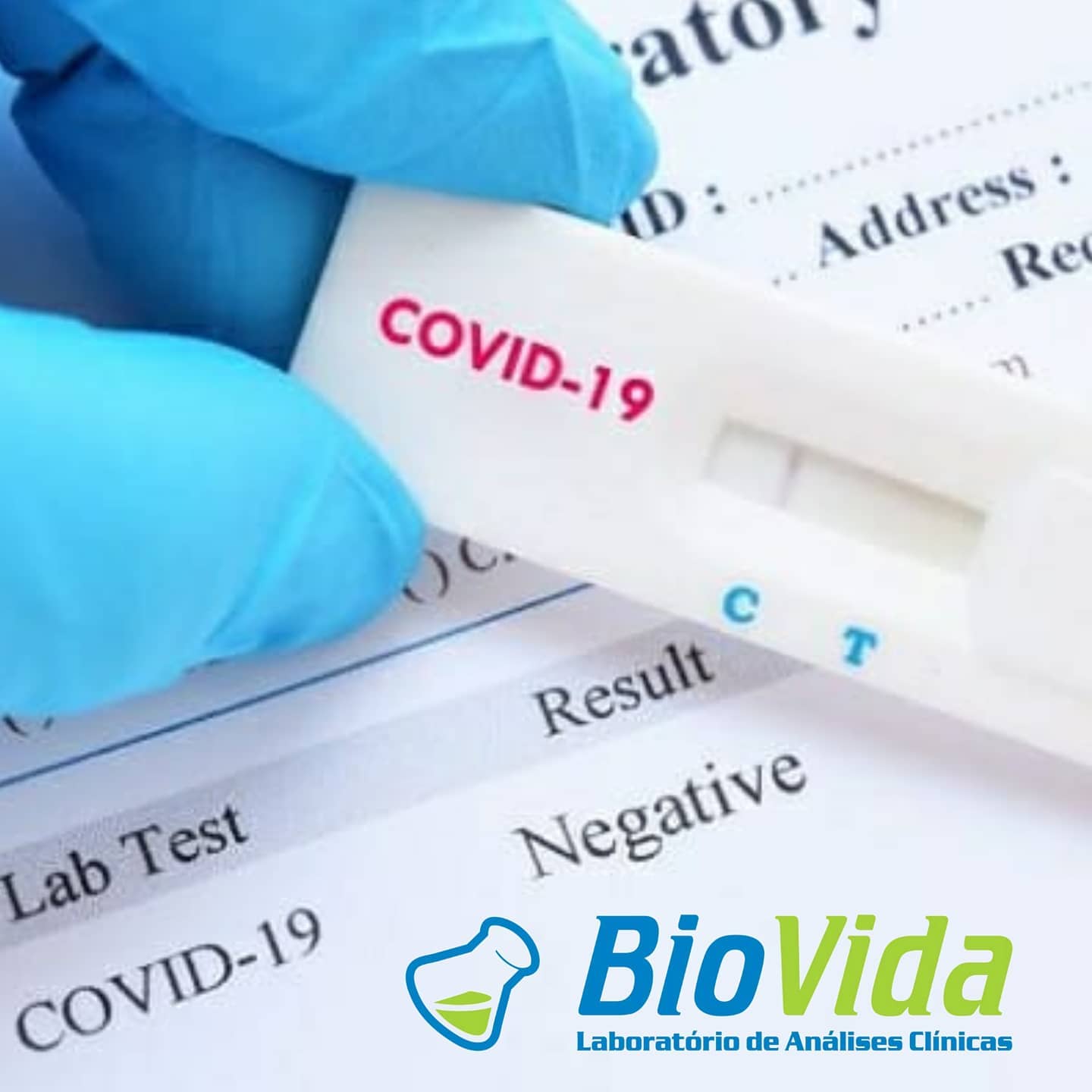 O Laboratório BioVida esta realizando os seguintes testes para covid-19: content media