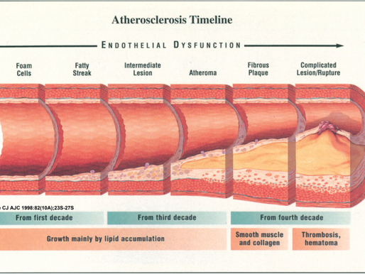 10 remedios naturales para la hipertensión arterial