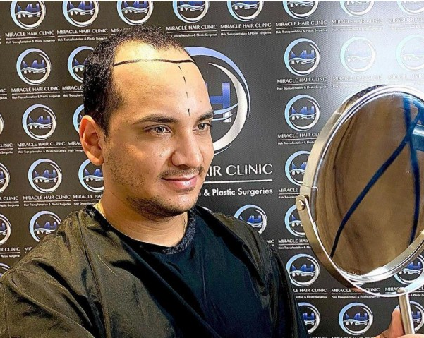 What makes Turkey a great destination for hair transplantation? content media