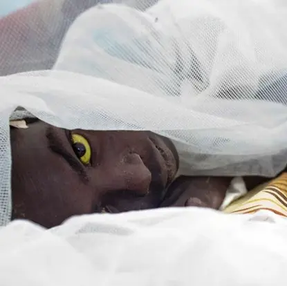 The 7 worst epidemics in history that have caused the death of millions of people