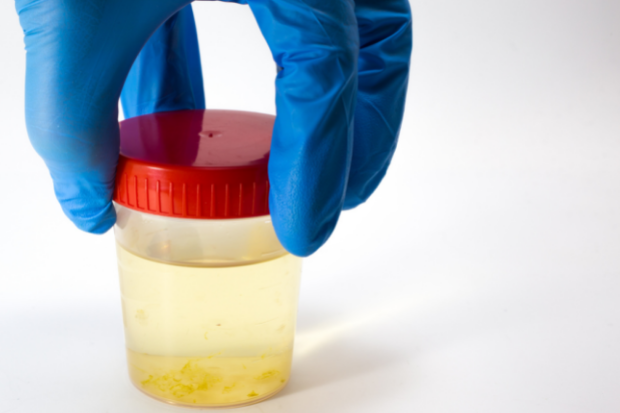 In Japan, a urine test to detect mental health risks
content media