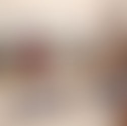 SU needs new food options