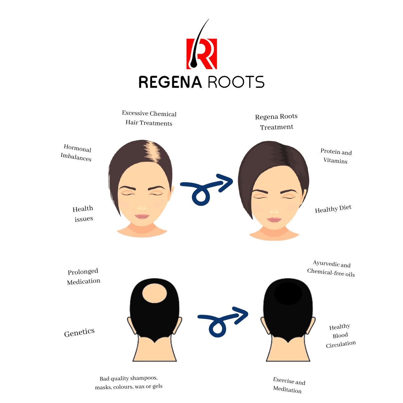 Hair fall treatment - natural ingredients for healthy hair | Regena Roots content media