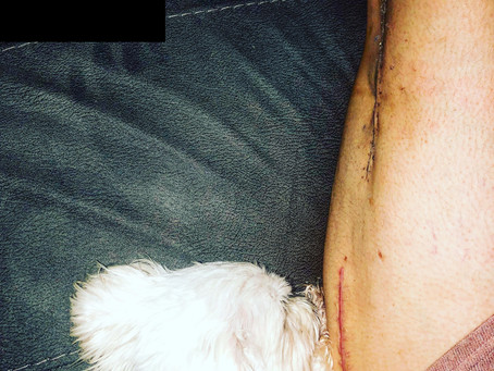 21 staples