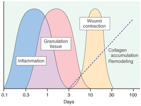 The Inflammation Cycle and Chronic Wounds