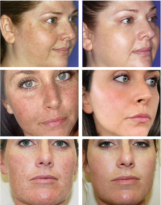 Nulavance Face with Shea Butter & Ocean Complex. Reduce Wrinkles & Fine Lines content media