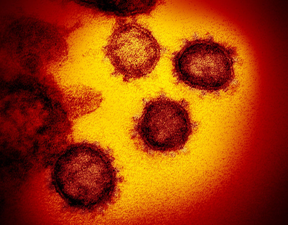 Valley View: Coronavirus