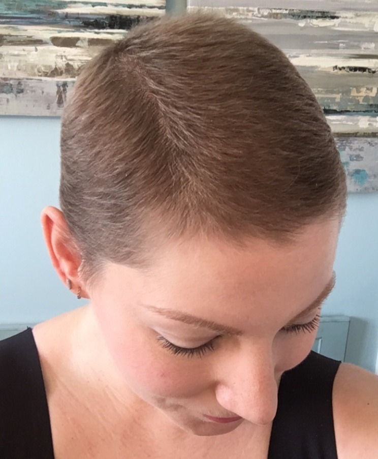 Guest Blog | Tips for Post-Chemo Hair Growth
