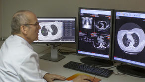 Descubren nuevo tipo de cáncer de pulmón, es muy agresivo y no se relaciona con el tabaco 