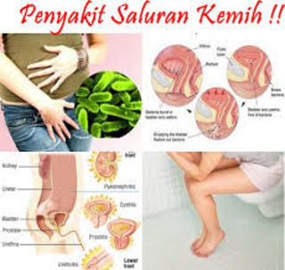 Cara Menyembuhkan Kencing Sakit Paling Cepat Di Apotik
