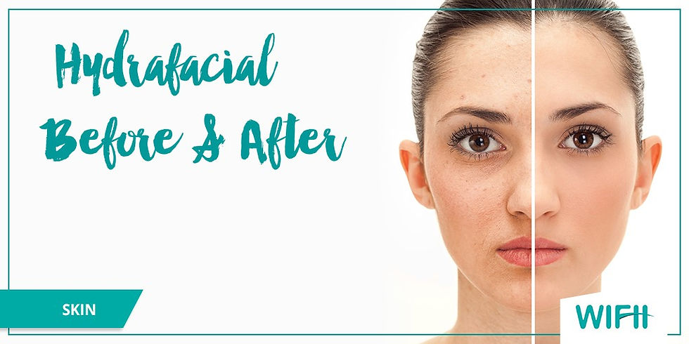 HydraFacial Grand Rapids Skin Envy Non Surgical Weightloss