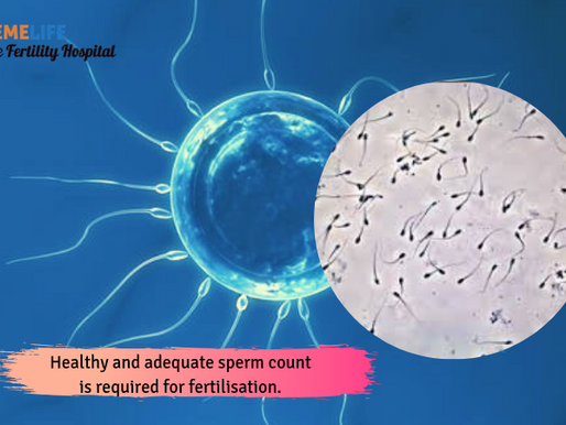 What is fertilisation and how it is achieved with ICSI?