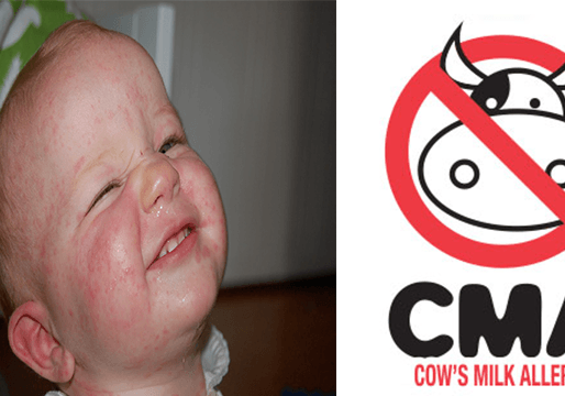 Cows Milk Protein Allergy.... Is it, isnt it?