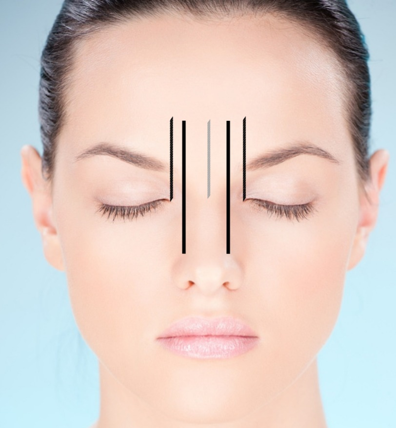 Brow Mapping