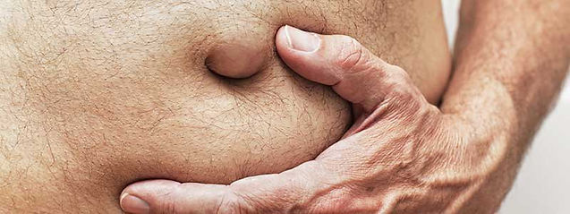 ¿Qué son las hernias?