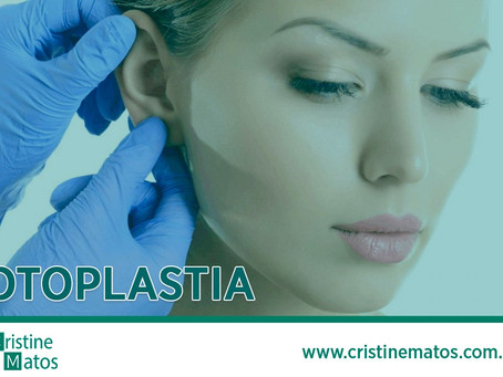 Otoplastia