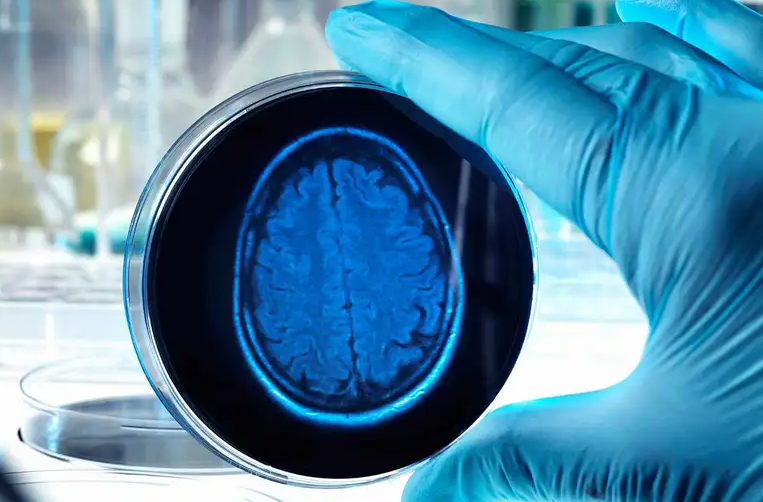 Brain organoid