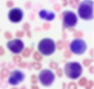 Нормобласты