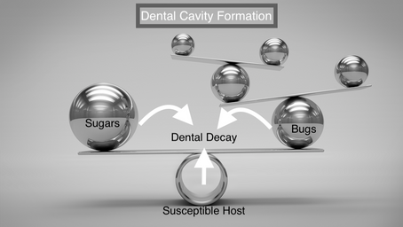 Story Of Dental Cavities