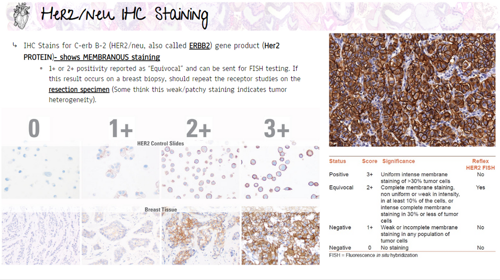 ER/PR/Her2 Receptor studies in Breast Cancer