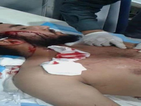 التفاصيل الكاملة للجريمة البشعة التي نفذتها عصابة نسائية بعدن
أخبار محلية
الأربعاء - 04 ديسمبر 2019