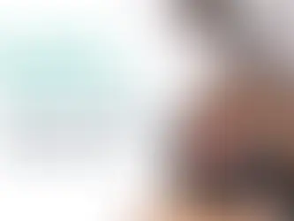 Carbon Laser Peeling