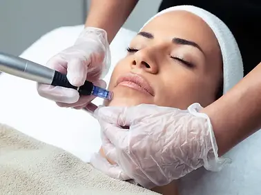 Collagen Induction Therapy