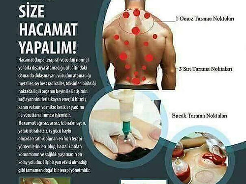 Hacamat | 0 546 774 48 31